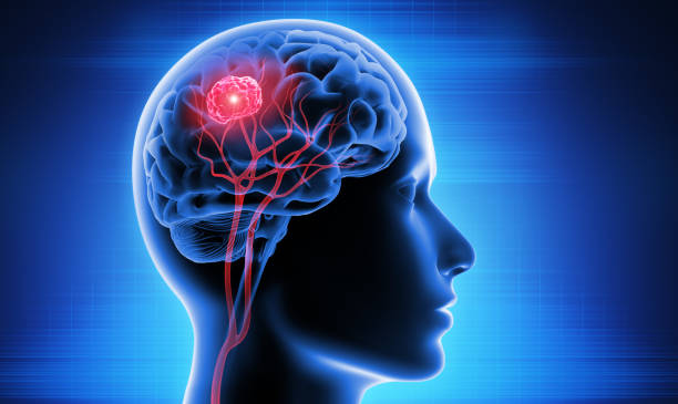 Explainable Brain Tumour MRI App